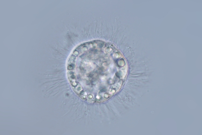 Moule (Mytilus edulis) - larve trochophore x80